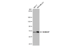 Anti-N-WASP antibody [GT1328] used in Western Blot (WB). GTX03240
