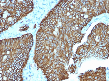 Anti-LI-Cadherin antibody [CDH17/2618] used in IHC (Paraffin sections) (IHC-P). GTX03259