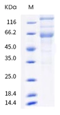SARS-CoV-2 (COVID-19) Spike (ECD) protein, B.1.617.2 / delta variant, His tag. GTX03345-pro