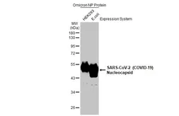 SARS-CoV-2 (COVID-19) Nucleocapsid protein, B.1.1.529 / Omicron variant, His tag. GTX03400-pro