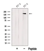 Anti-LTBP2 antibody used in Western Blot (WB). GTX03454