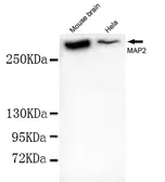 Anti-MAP2 antibody [1D7-B9-C8-F6] used in Western Blot (WB). GTX03485