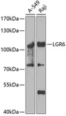 Anti-LGR6 antibody used in Western Blot (WB). GTX03496