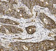 Anti-Claudin 3 antibody used in IHC (Paraffin sections) (IHC-P). GTX03712