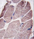 Anti-PTPD1 antibody used in IHC (Paraffin sections) (IHC-P). GTX03798