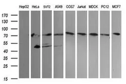 Anti-NCAM antibody [OTI1G4] used in Western Blot (WB). GTX04078