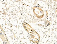 Anti-CCR2 antibody used in IHC (Paraffin sections) (IHC-P). GTX04115