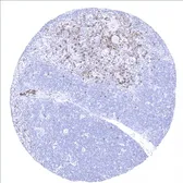 Anti-CD45RA antibody [MSVA-472M] HistoMAX&trade; used in IHC (Paraffin sections) (IHC-P). GTX04372