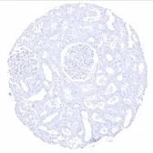 Anti-Cytokeratin 20 antibody [MSVA-620R] HistoMAX&trade; used in IHC (Paraffin sections) (IHC-P). GTX04376