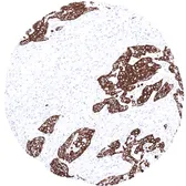 Anti-Cytokeratin 13 antibody [MSVA-613M] HistoMAX&trade; used in IHC (Paraffin sections) (IHC-P). GTX04385