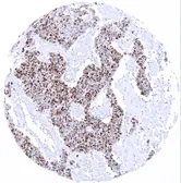 Anti-TdT antibody [MSVA-453R] HistoMAX&trade; used in IHC (Paraffin sections) (IHC-P). GTX04417