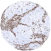 Anti-Vimentin antibody [MSVA-458R] HistoMAX&trade; used in IHC (Paraffin sections) (IHC-P). GTX04418
