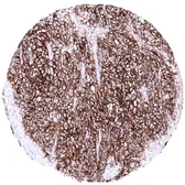 Anti-ACE2 antibody [MSVA-919R] HistoMAX&trade; used in IHC (Paraffin sections) (IHC-P). GTX04425