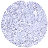 Anti-Her2 / ErbB2 antibody [MSVA-340R] HistoMAX&trade; used in IHC (Paraffin sections) (IHC-P). GTX04428