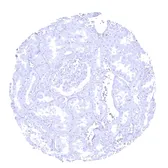 Anti-Elastase 3B antibody [MSVA-410M] HistoMAX&trade; used in IHC (Paraffin sections) (IHC-P). GTX04445