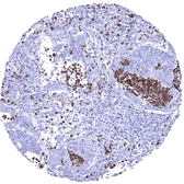 Anti-S100A12 antibody [MSVA-812M] HistoMAX&trade; used in IHC (Paraffin sections) (IHC-P). GTX04449