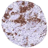 Anti-HLA-DRB1 antibody [MSVA-478R] HistoMAX&trade; used in IHC (Paraffin sections) (IHC-P). GTX04457