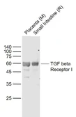 Anti-TGF beta Receptor I antibody used in Western Blot (WB). GTX04547