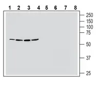 Anti-NMUR1 antibody used in Western Blot (WB). GTX04577