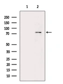 Anti-PKC beta 1 (phospho Ser661) antibody used in Western Blot (WB). GTX04593