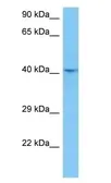 Anti-YKL-39 antibody used in Western Blot (WB). GTX04608