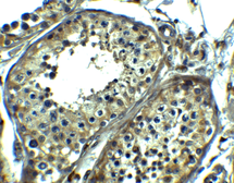 Anti-SRPK1 antibody used in IHC (Paraffin sections) (IHC-P). GTX04611