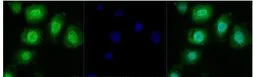 Anti-TRPM2 antibody used in Immunocytochemistry/ Immunofluorescence (ICC/IF). GTX04802