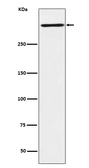 Anti-Reelin antibody [ACFE-18] used in Western Blot (WB). GTX04830