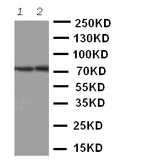 Anti-ABCG4 antibody used in Western Blot (WB). GTX04835