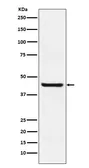 Anti-Septin 2 antibody [18S62] used in Western Blot (WB). GTX04847