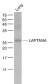 Anti-LAPTM4A antibody used in Western Blot (WB). GTX04850
