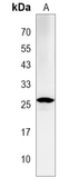 Anti-LAPTM4A antibody used in Western Blot (WB). GTX04851