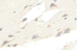 Anti-OPCML antibody used in IHC (Paraffin sections) (IHC-P). GTX04867