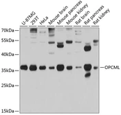 Anti-OPCML antibody used in Western Blot (WB). GTX04868