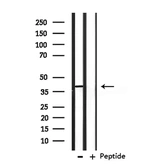 Anti-OPCML antibody used in Western Blot (WB). GTX04869
