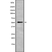 Anti-5-HT2A receptor antibody used in Western Blot (WB). GTX04873