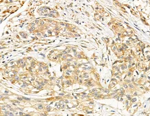 Anti-SLC22A8 antibody used in IHC (Paraffin sections) (IHC-P). GTX04875