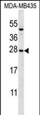 Anti-KLRC1 antibody used in Western Blot (WB). GTX04877