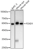 Anti-FOXD1 antibody used in Western Blot (WB). GTX04879