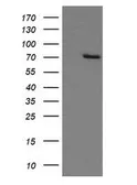 Anti-beta-Gal antibody [OTI10B2] used in Western Blot (WB). GTX04881