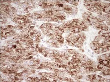 Anti-NR0B2 antibody [OTI7B5] used in IHC (Paraffin sections) (IHC-P). GTX04884