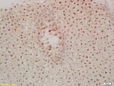 Anti-MST1 antibody used in IHC (Paraffin sections) (IHC-P). GTX04891