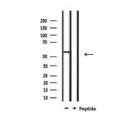 Anti-SMAD1+5+8(9) antibody used in Western Blot (WB). GTX04895