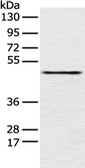 Anti-PCID2 antibody used in Western Blot (WB). GTX04896