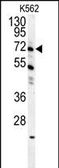 Anti-GAS2L1 antibody used in Western Blot (WB). GTX04904