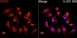 Anti-p75 NGF Receptor / CD271 antibody used in Immunocytochemistry/ Immunofluorescence (ICC/IF). GTX04906