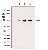 Anti-Tyrosinase antibody used in Western Blot (WB). GTX04909