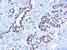 Anti-Wilms Tumor 1 antibody [6F-H2] (ready-to-use) used in IHC (Paraffin sections) (IHC-P). GTX04961