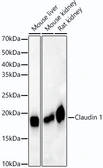 Anti-Claudin 1 antibody [ARC54475] used in Western Blot (WB). GTX04993