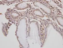 Anti-GOLGA3 antibody [C3], C-term used in IHC (Paraffin sections) (IHC-P). GTX100288